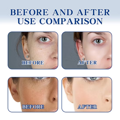 Buy 1 Get 1 Free - Chalonese Brightening Cream